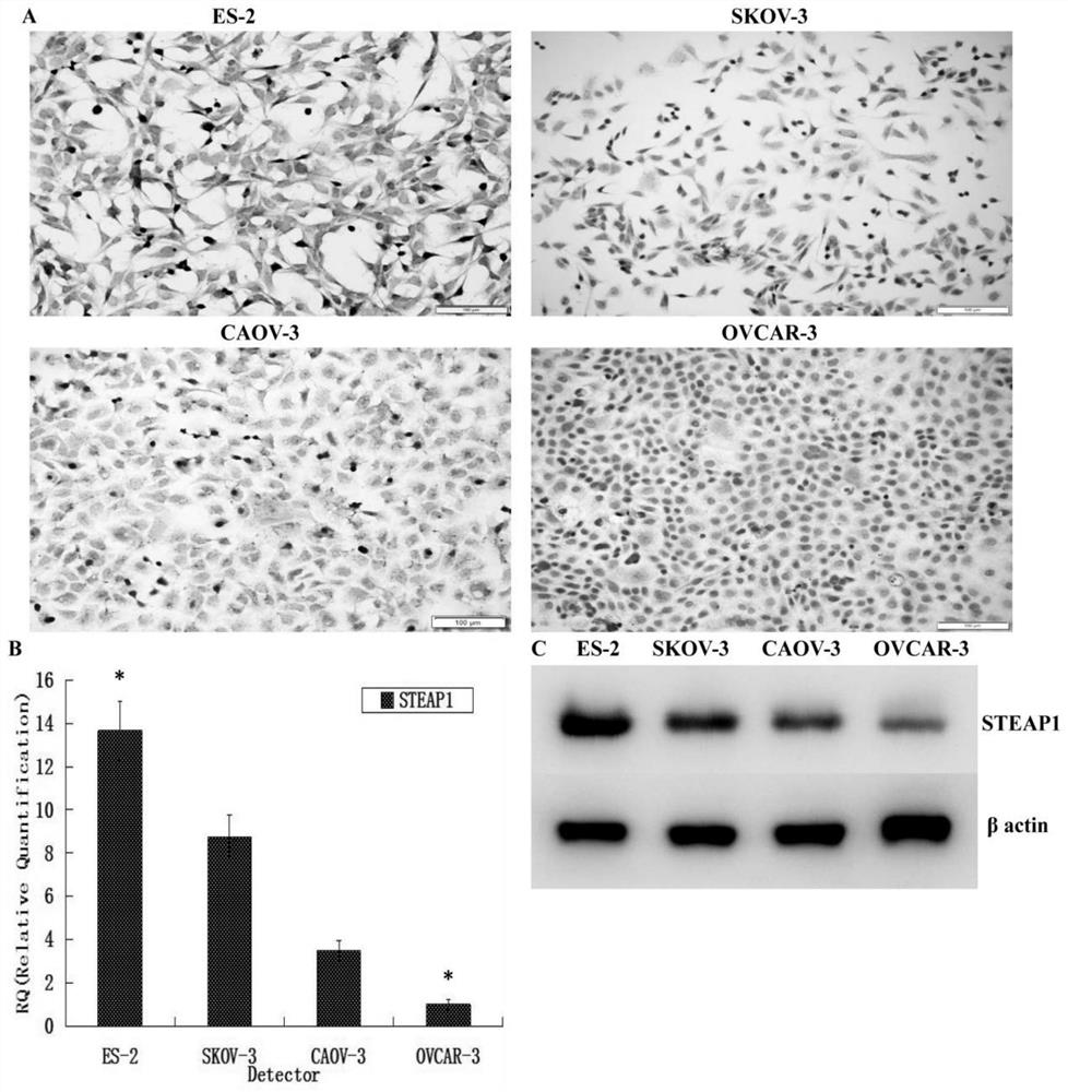 Application of Steap1 in the diagnosis, treatment and prognosis of ovarian cancer