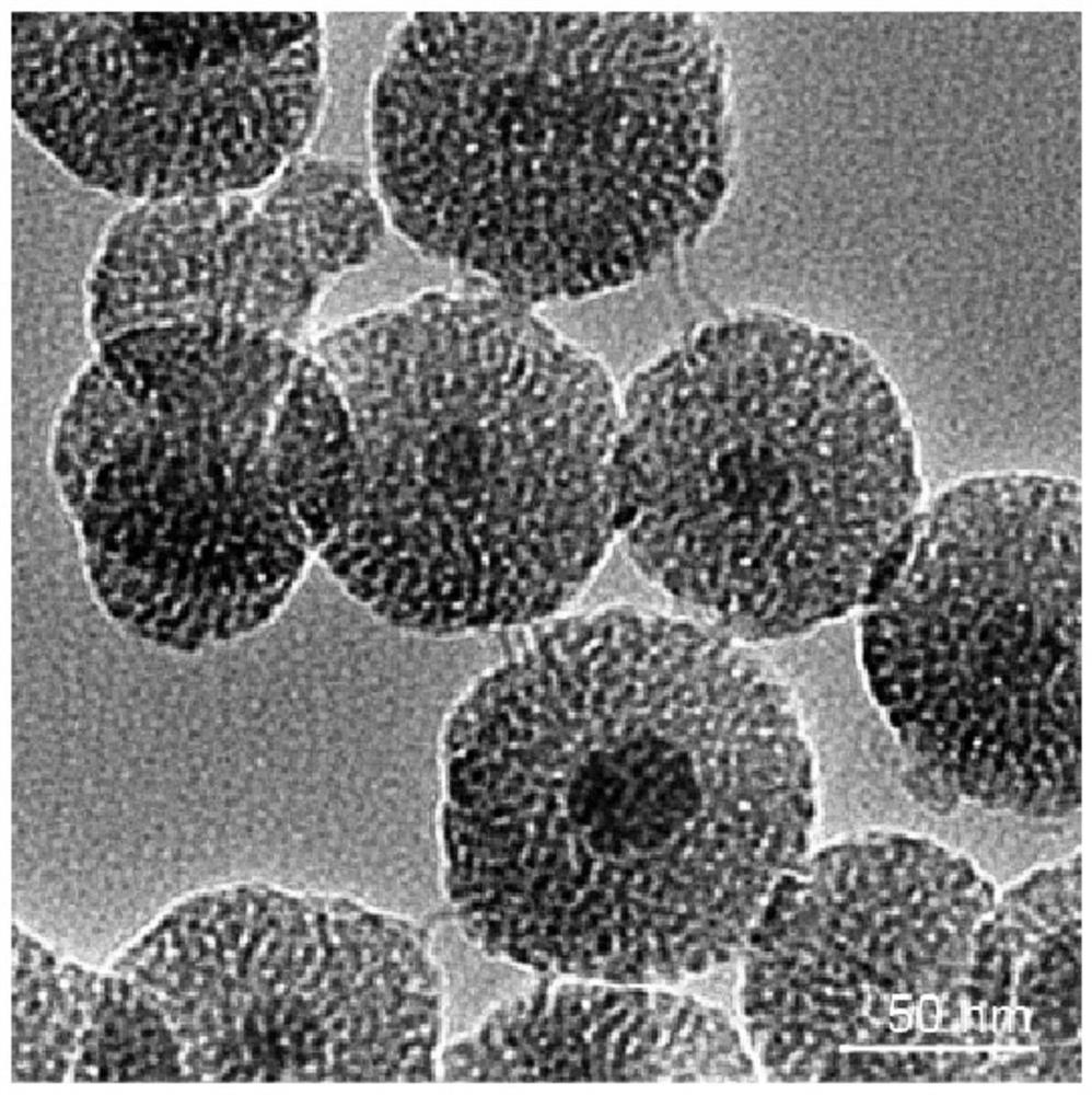 Brain glioma targeting system based on magnetic nanoparticle composite engineered exosome and application of brain glioma targeting system