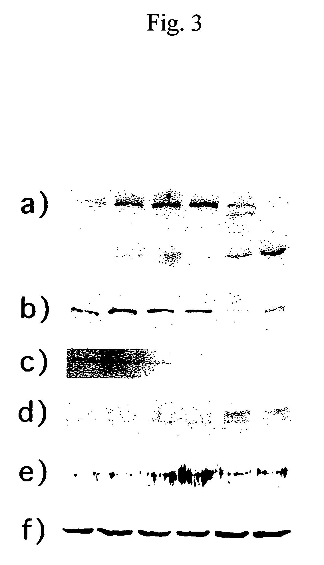 Agent for treating chondroma and chondrosarcoma