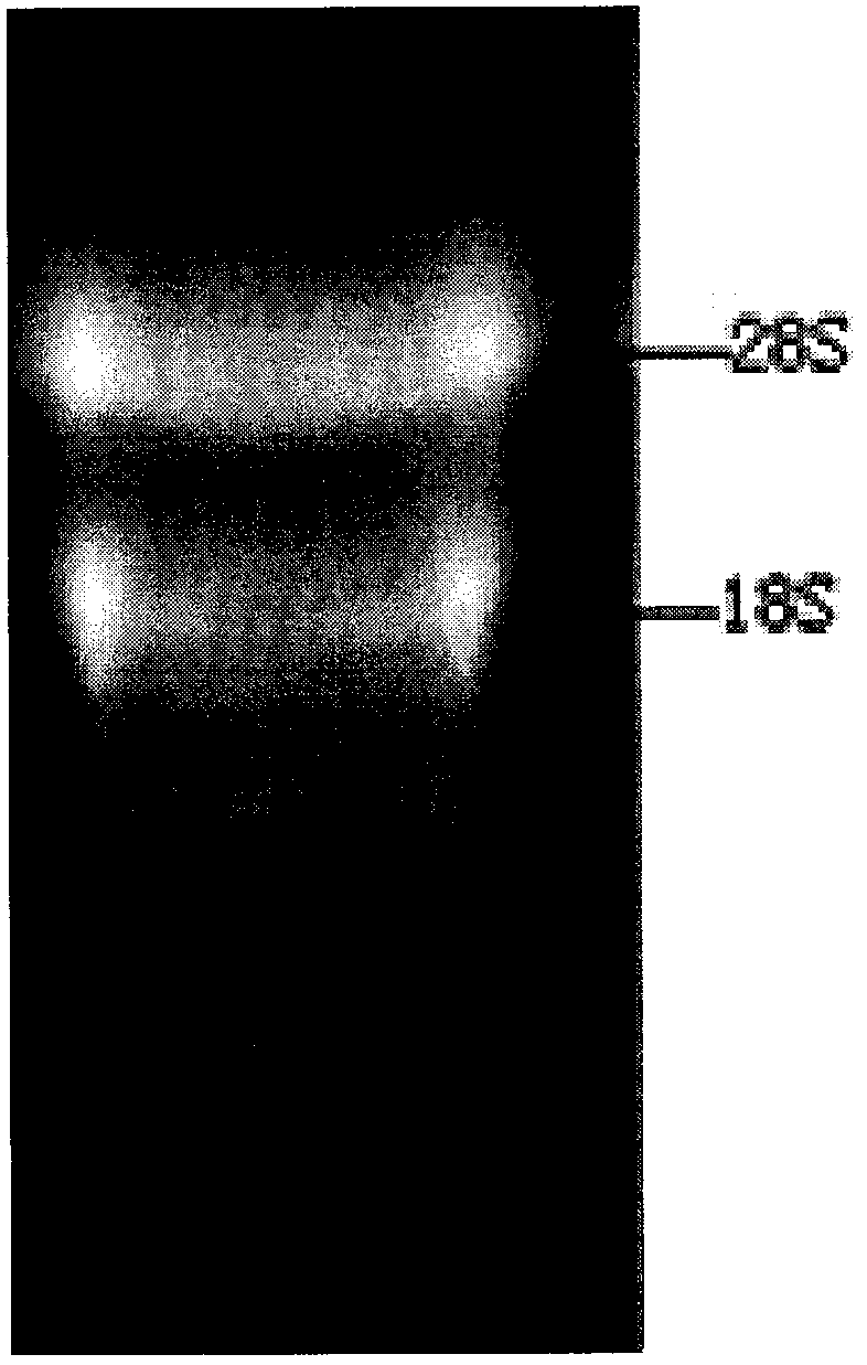 Method for extracting total RNA from leucaena leucocephala leaf tissue