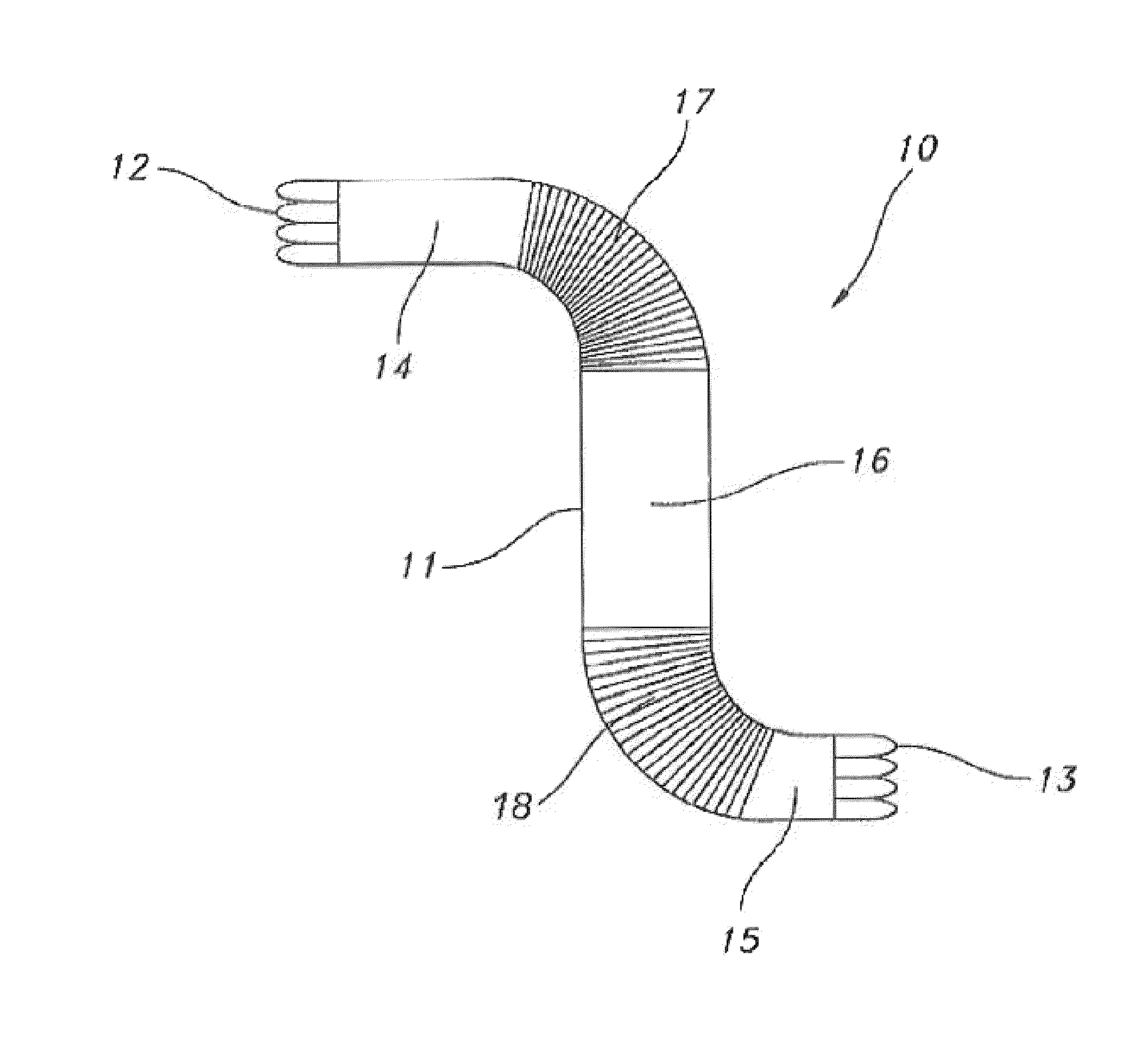 Sectional crimped graft