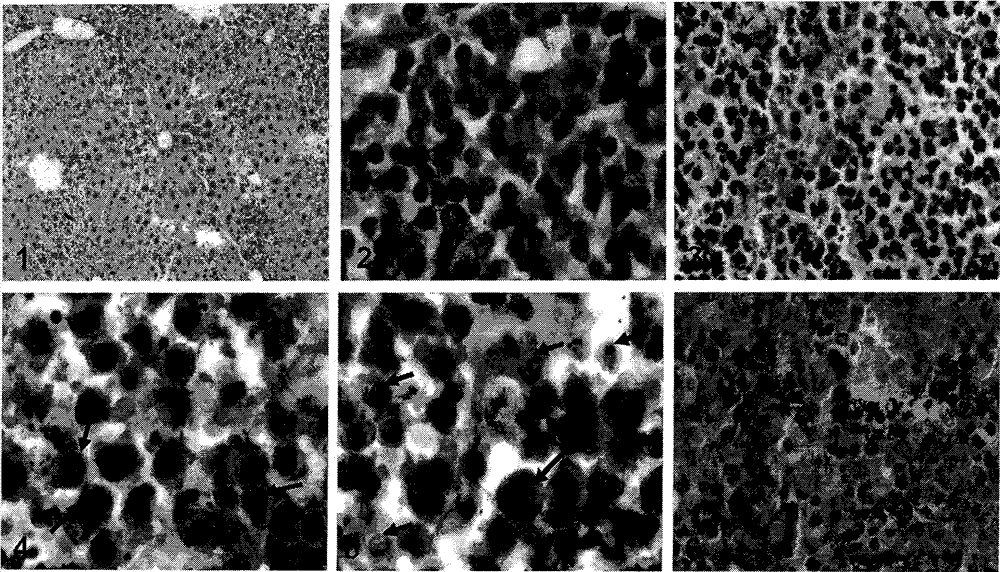 Preparation method of muramyl dipeptide-anti-CD20 immune conjugate and application thereof