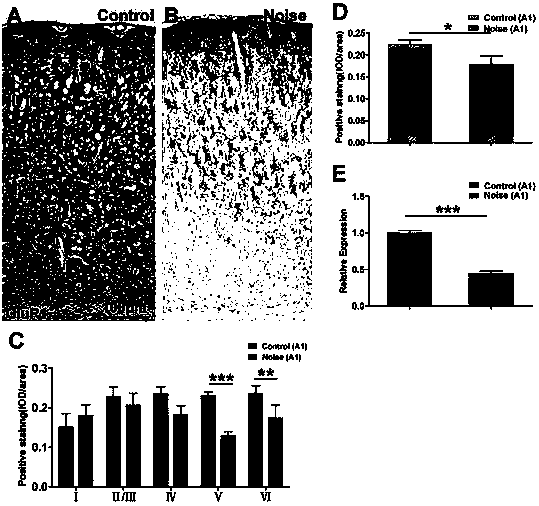 Application of ionotropic glutamate receptor