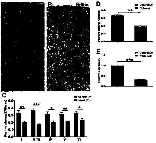 Application of ionotropic glutamate receptor