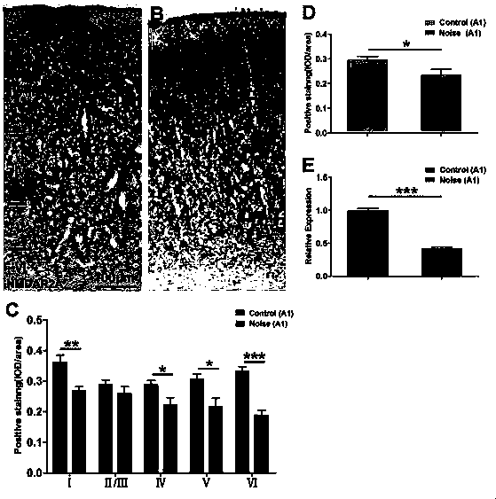 Application of ionotropic glutamate receptor