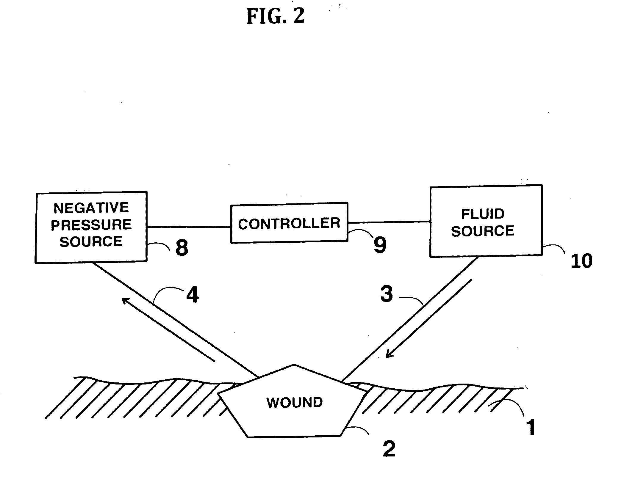 Method for dressing a wound