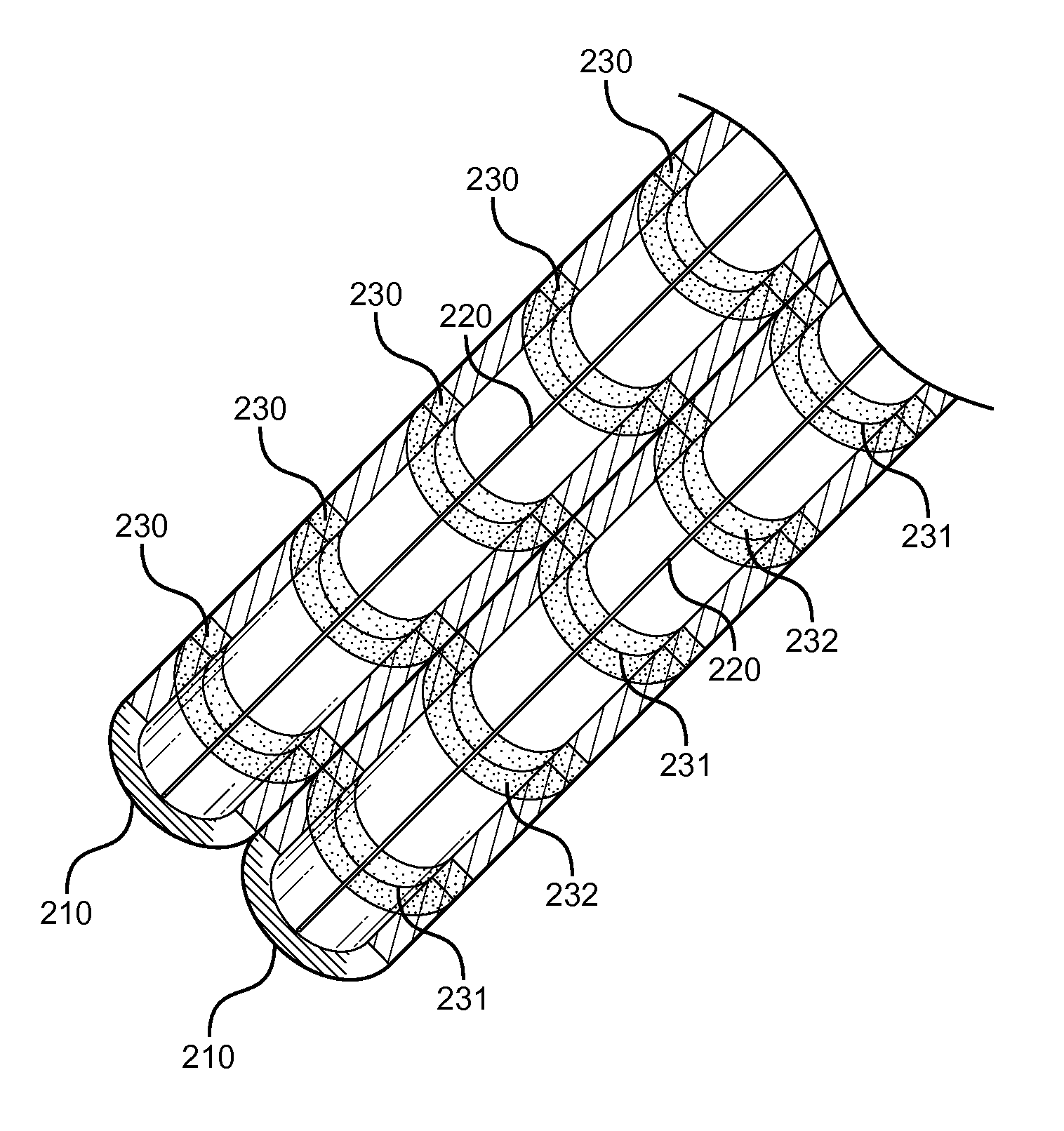 Subcutaneous Dialysis Catheter with Ultrasound  Agitation