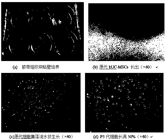 Method for in-vitro directional differentiation inducing of mesenchymal stem cell towards melanocyte