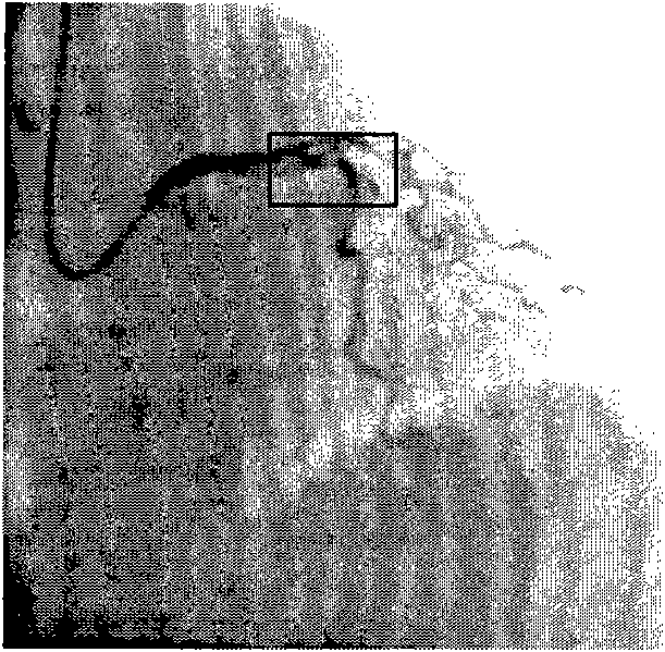 Method for segmenting blood vessel in digital subtraction angiography (DSA) image sequence