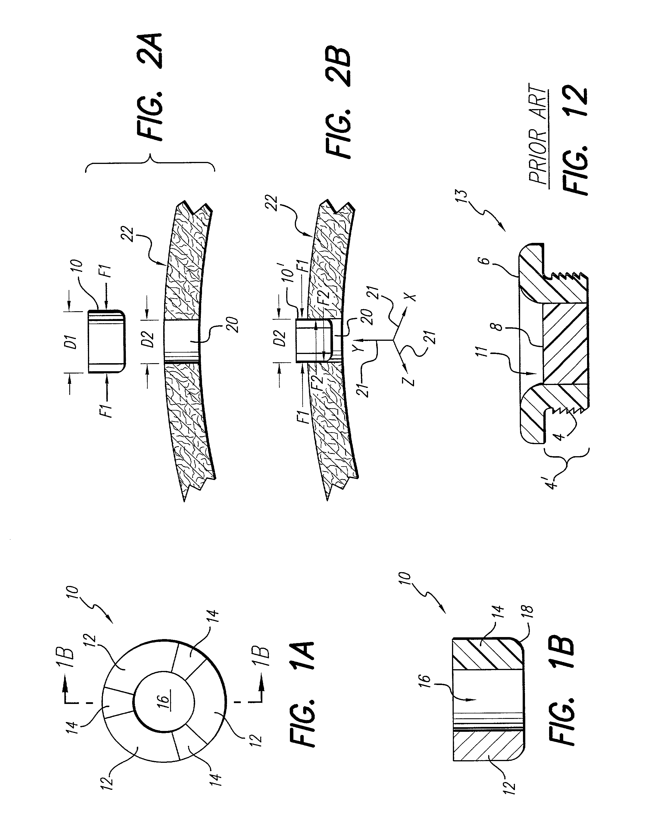 Cranial sealing plug