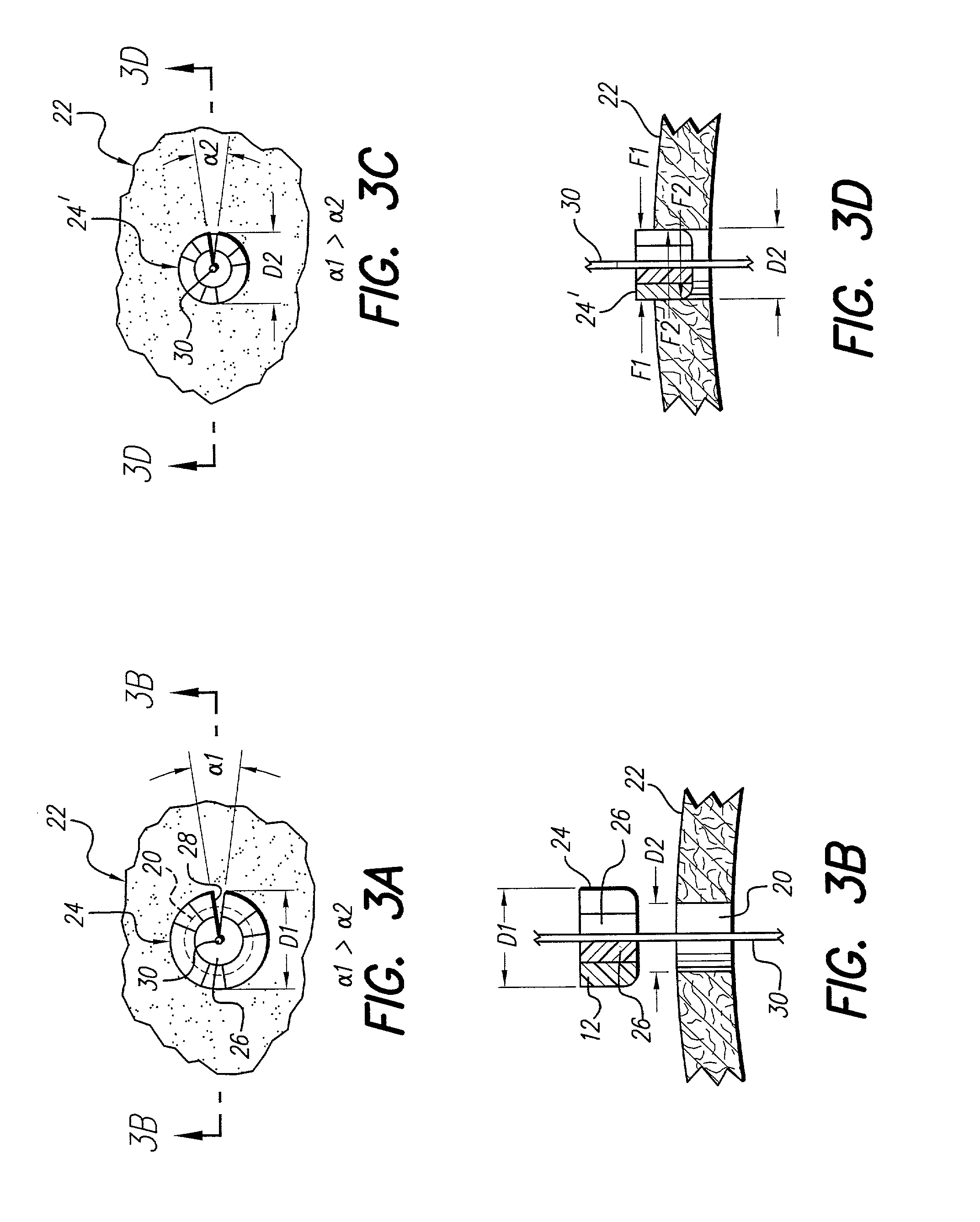 Cranial sealing plug