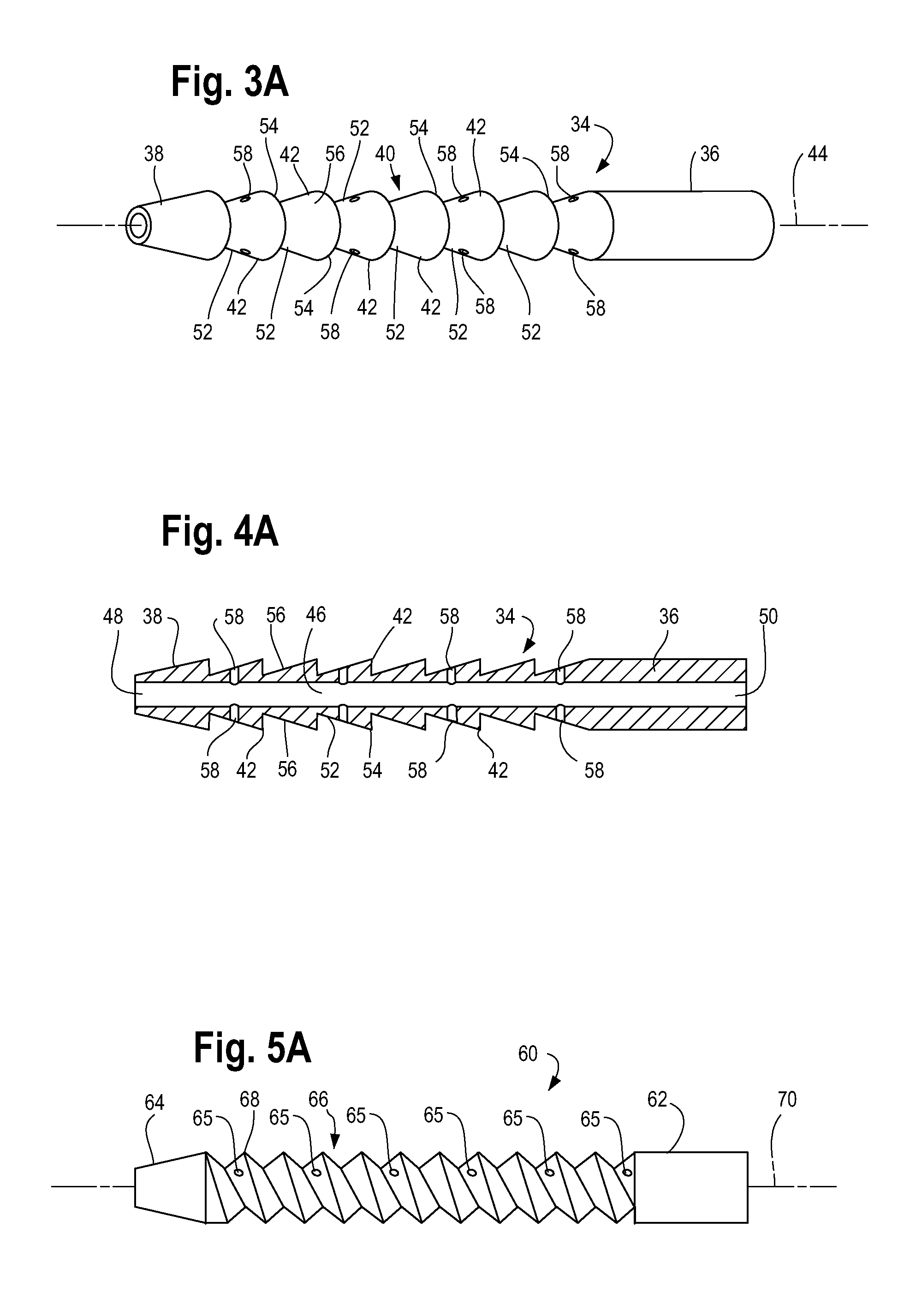 Implant and system for bone repair