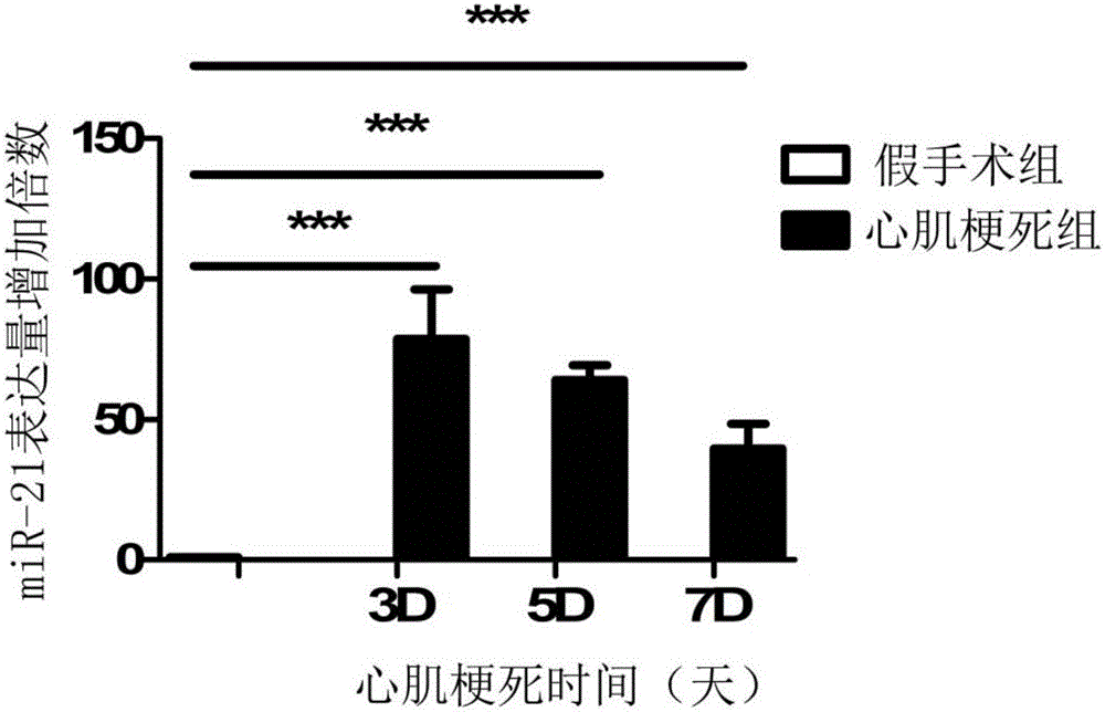 miRNA-21a inhibitor and application thereof in preparing medicine for delaying myocardial infarction