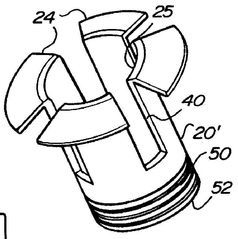 Cast ventilation system