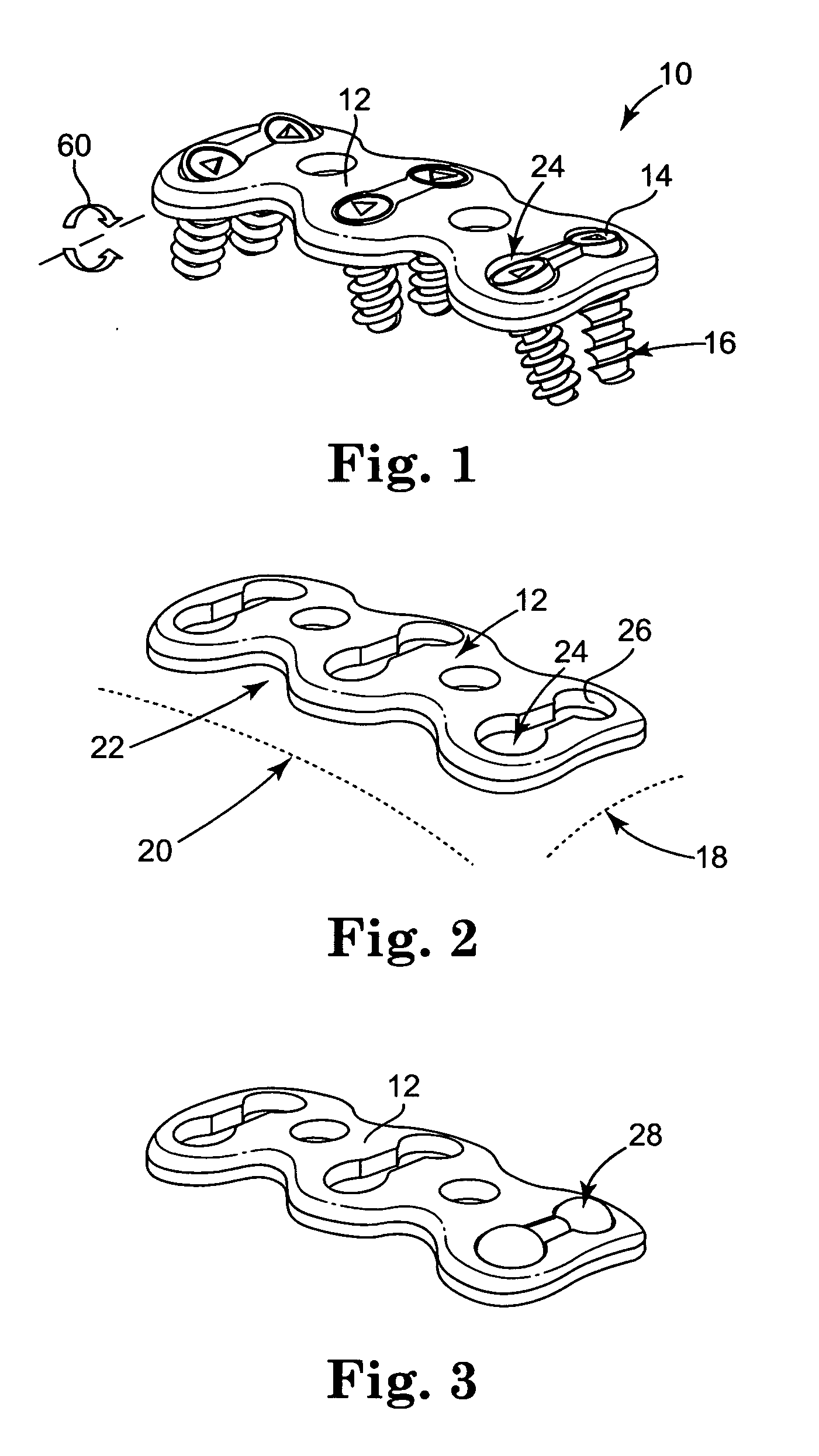 Cervical plate system having an insertable rotating element