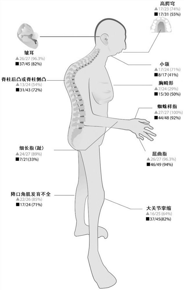 Novel FBN2 gene mutation marker and application thereof in CCA auxiliary diagnosis