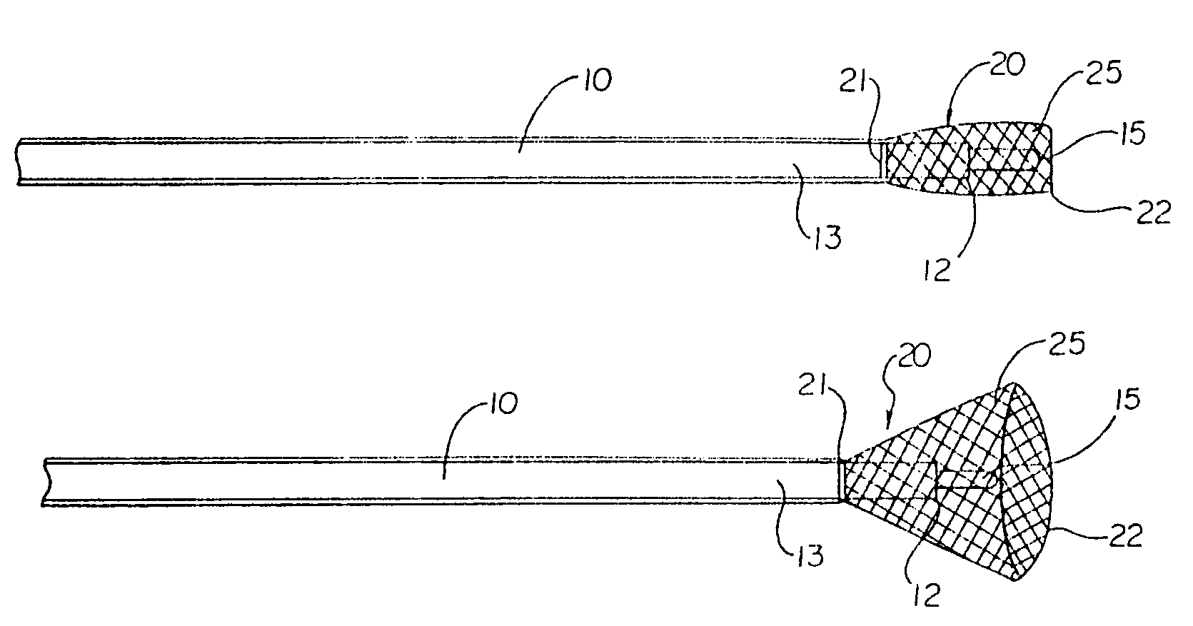 Percutaneous catheter and guidewire for filtering during ablation of myocardial or vascular tissue