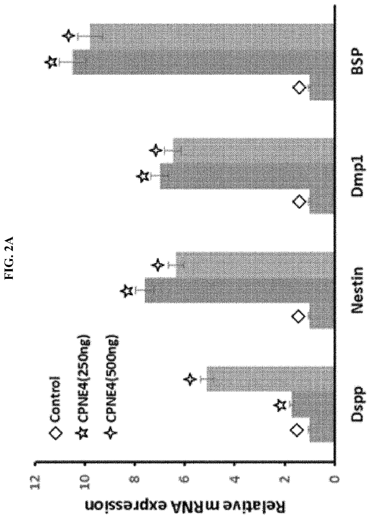 Pharmaceutical composition for preventing or treating dentin-dental pulp diseases or periodontal disease including cpne4 protein