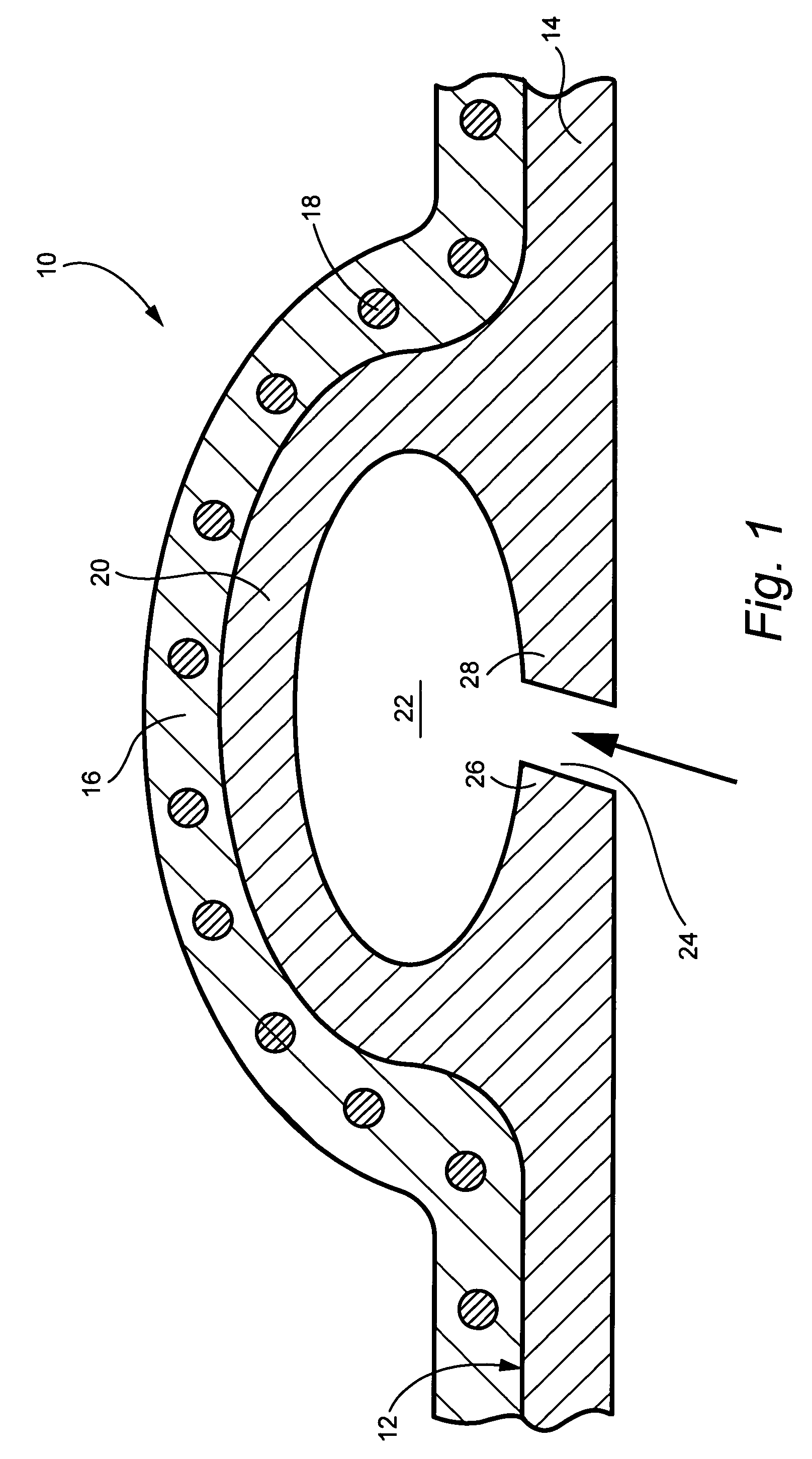 Bolt-on radial bleed manifold