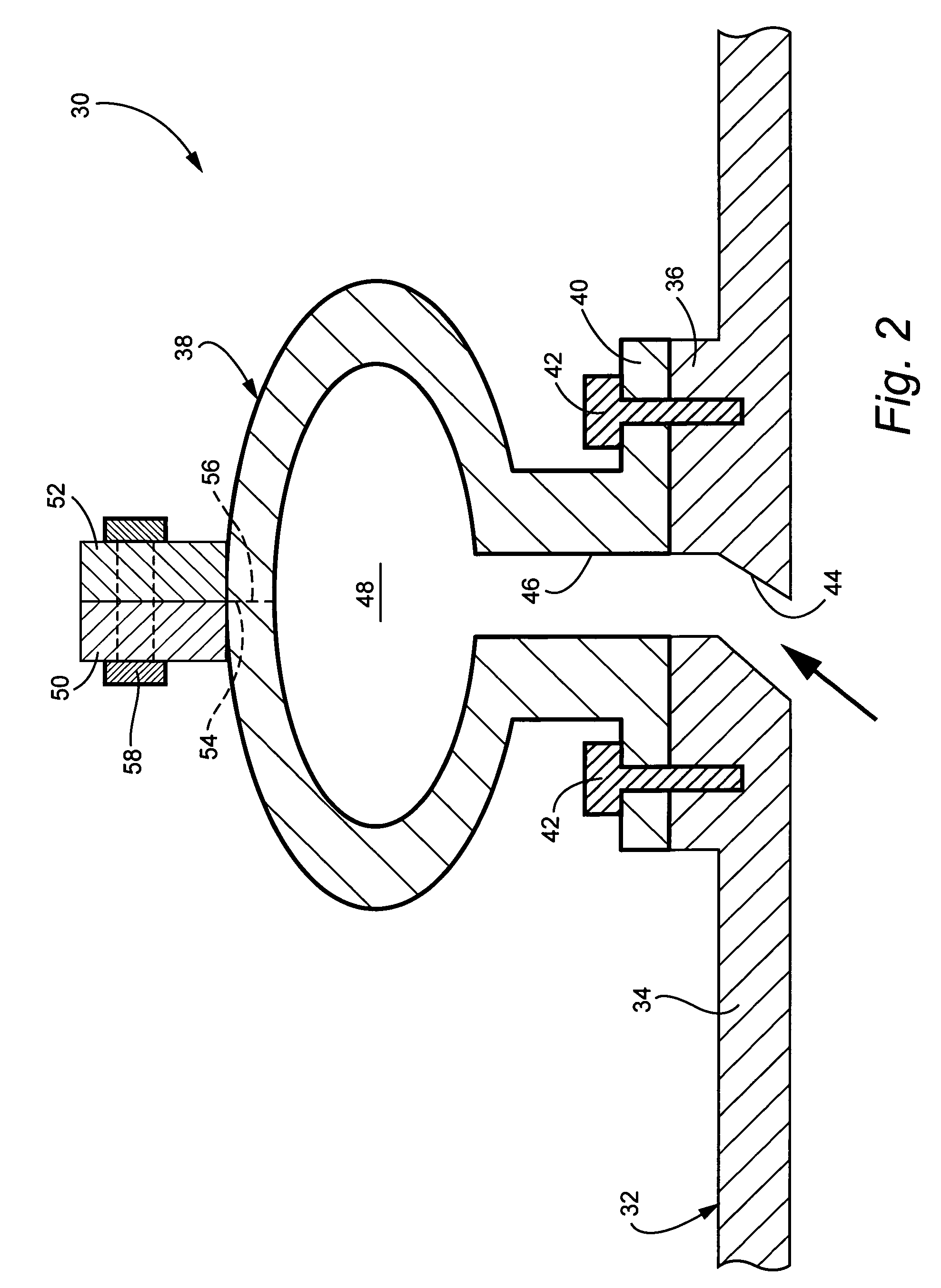 Bolt-on radial bleed manifold