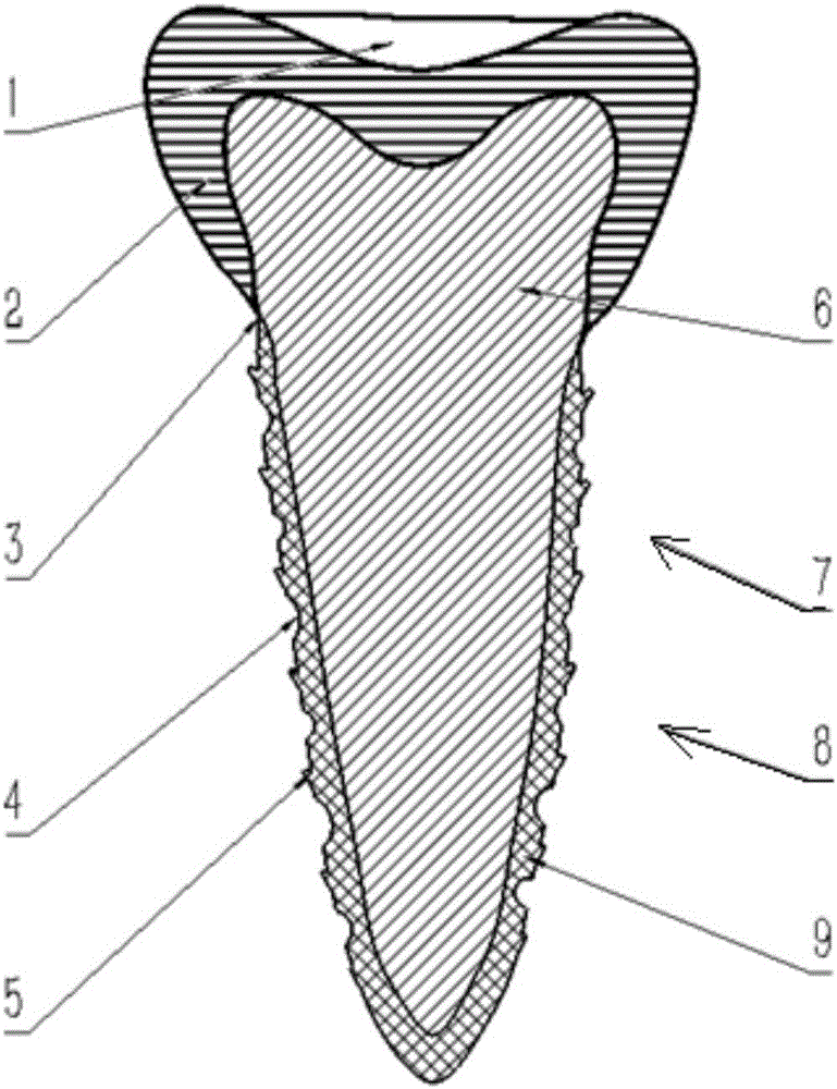 3D printing-based bionic artificial tooth and manufacturing method thereof