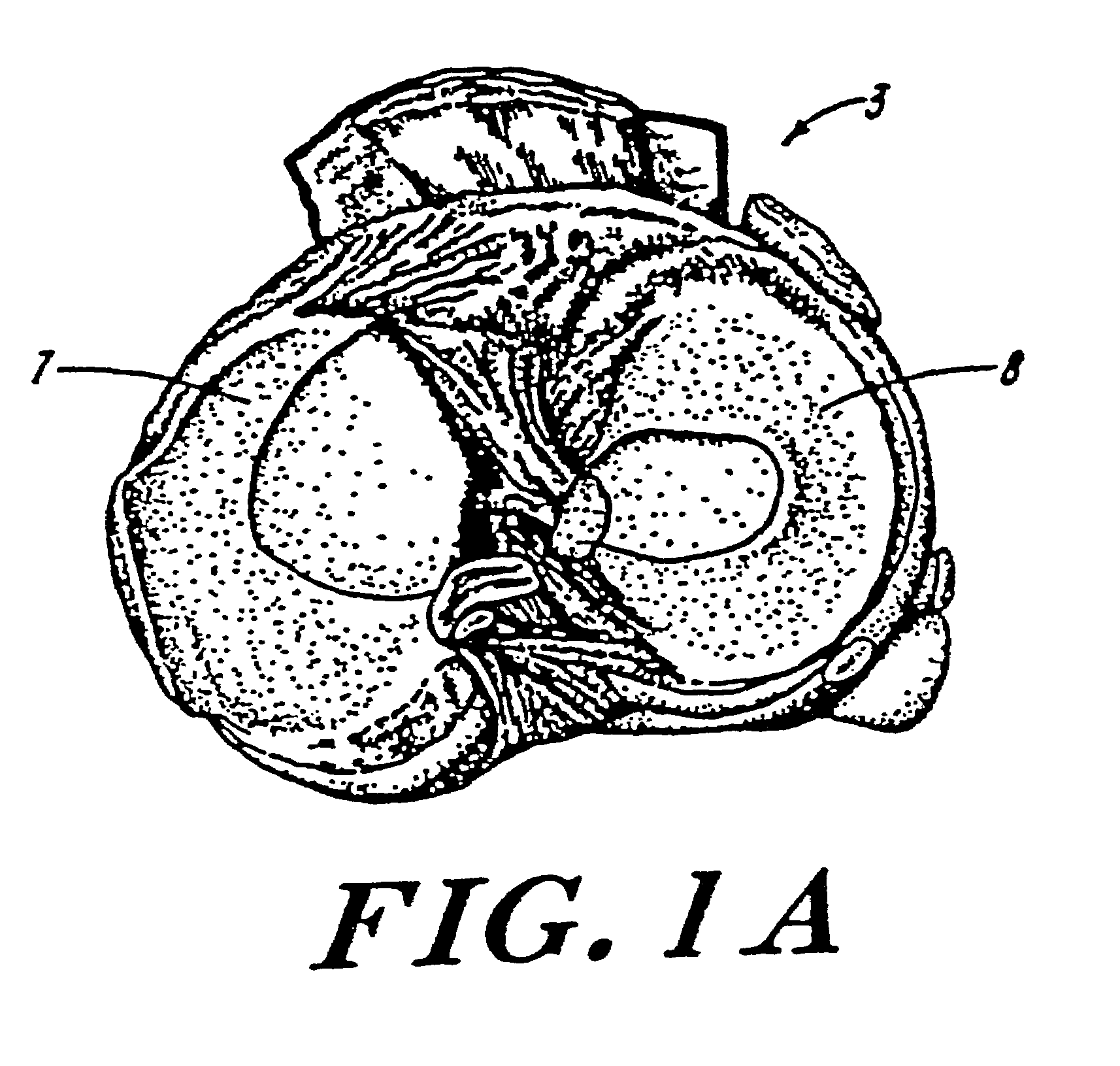 Galactosidase-treated prosthetic devices