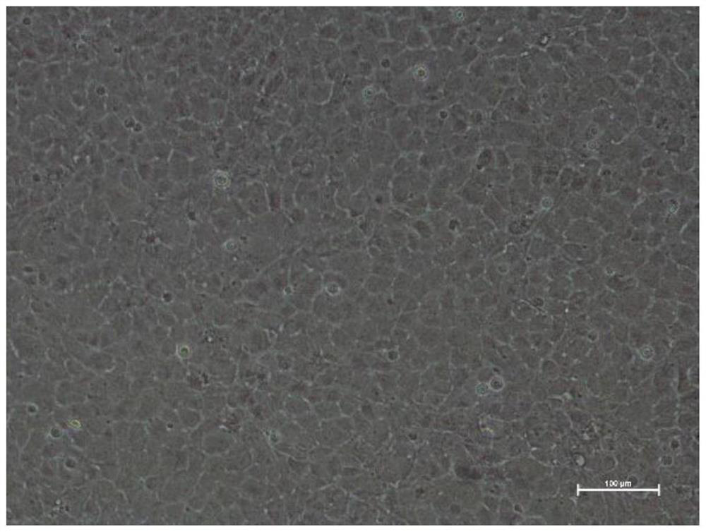 Corneal endothelial membrane based on human corneal stroma as carrier