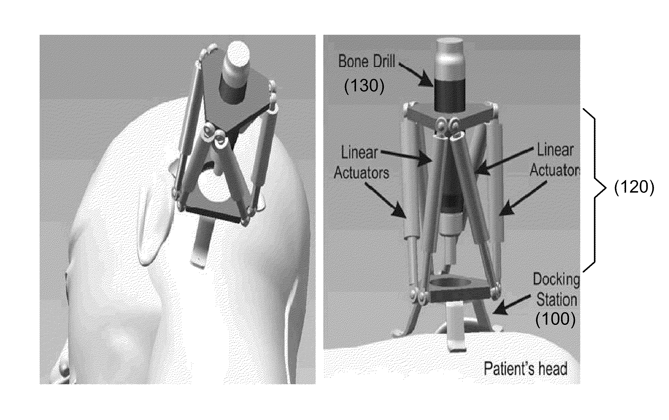 Apparatus and methods for percutaneous cochlear implantation