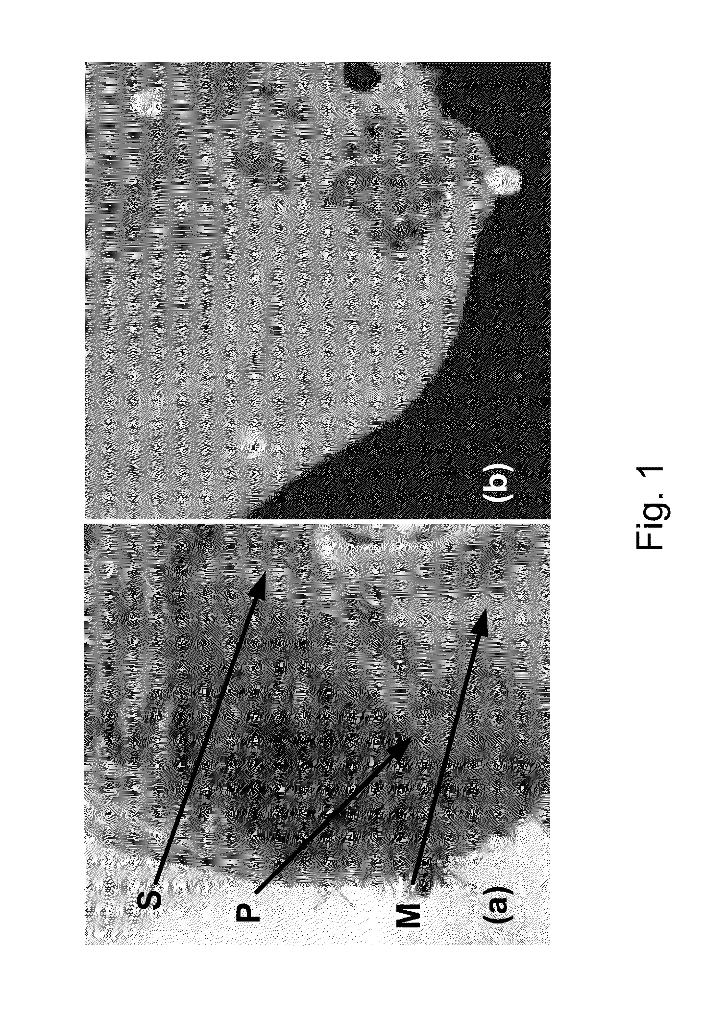 Apparatus and methods for percutaneous cochlear implantation