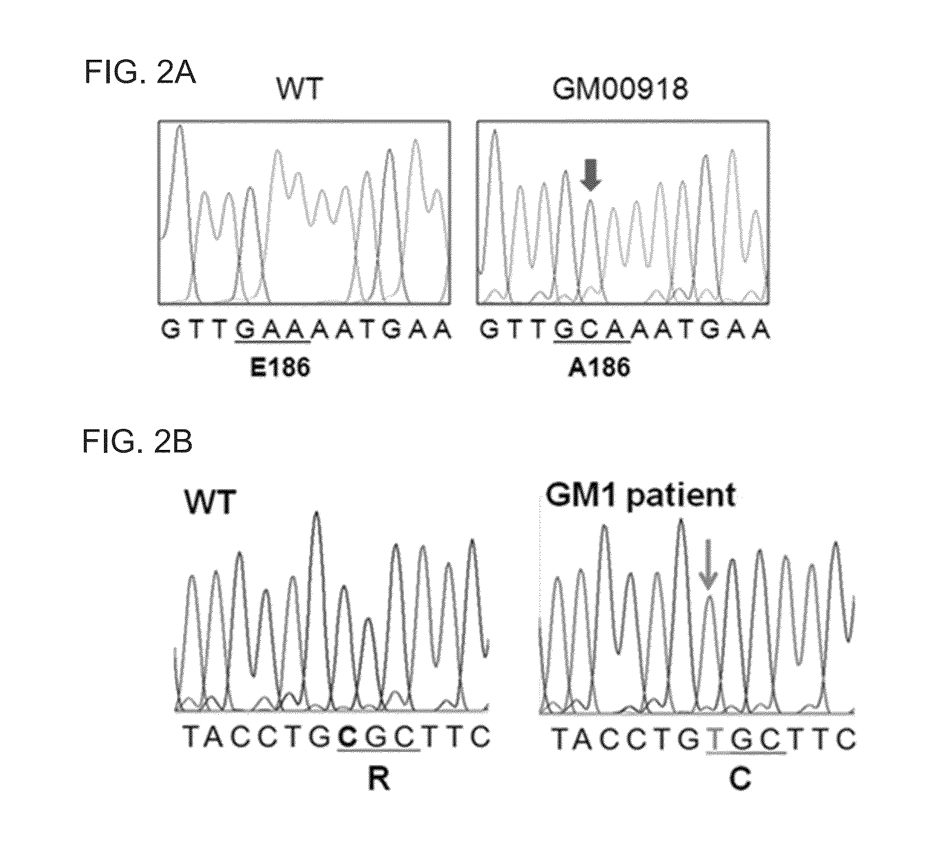 Method for treatment of gm1 gangliosidosis