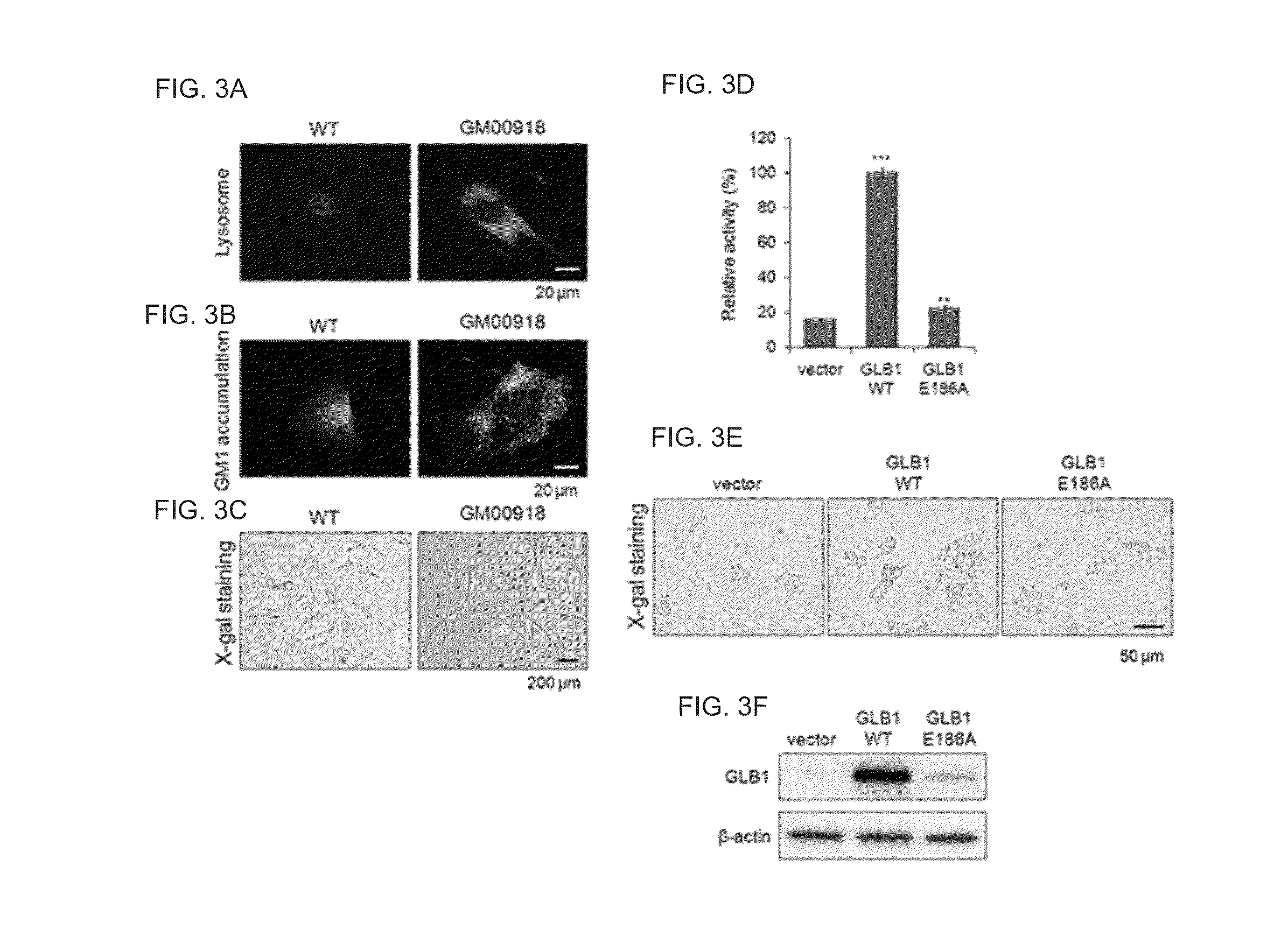 Method for treatment of gm1 gangliosidosis