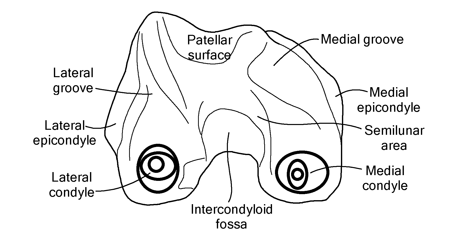 Methods for Determining Meniscal Size and Shape and for Devising Treatment