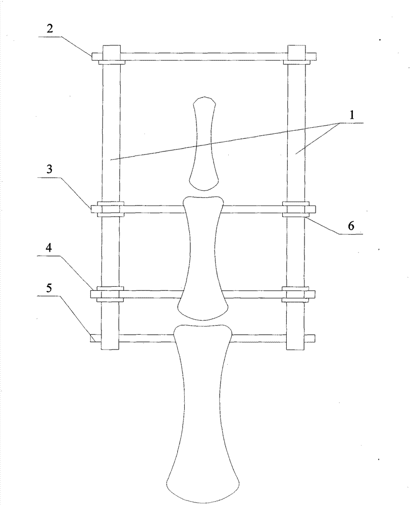 Hinge type dragging external fixing device