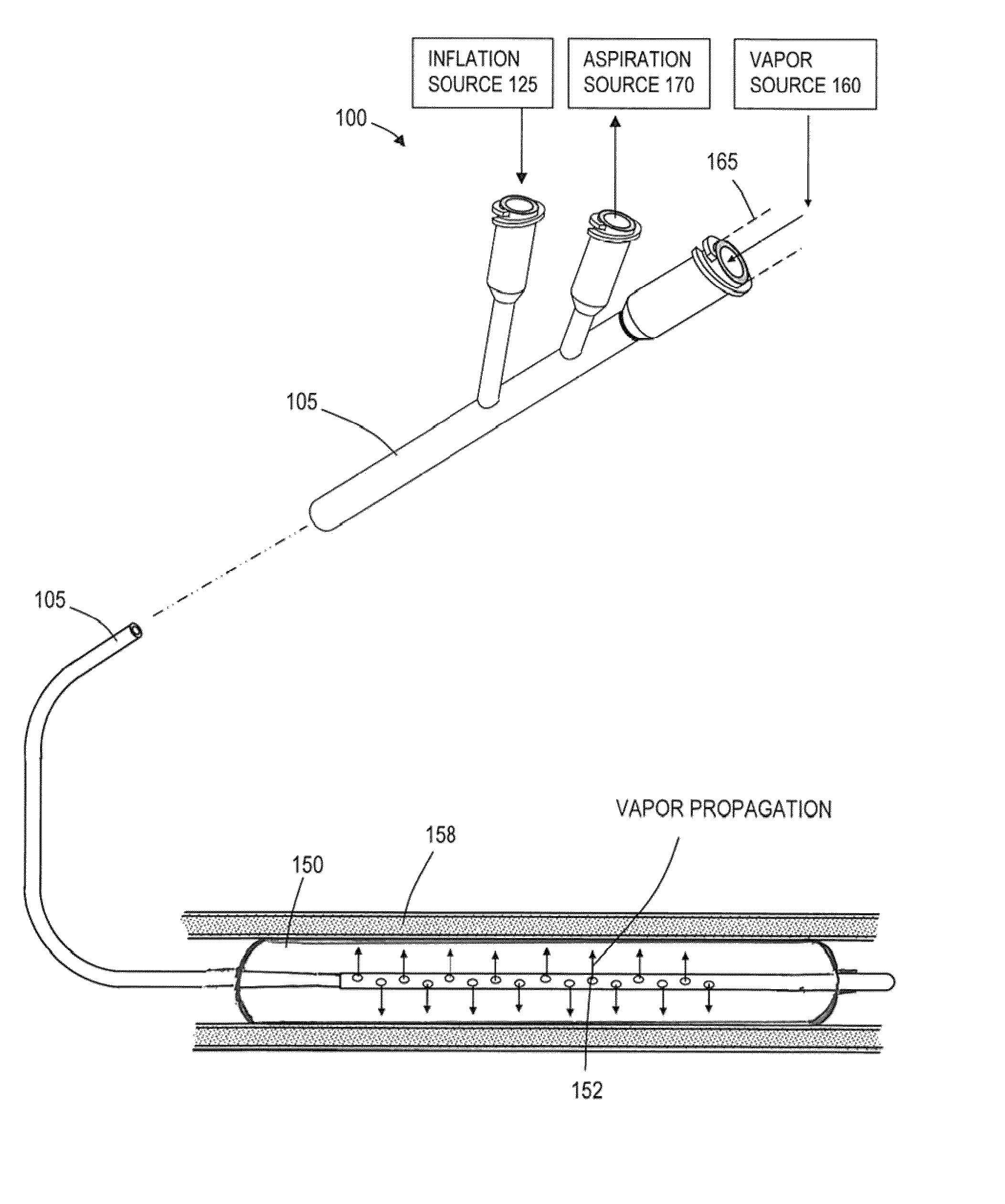 Medical probes for the treatment of blood vessels