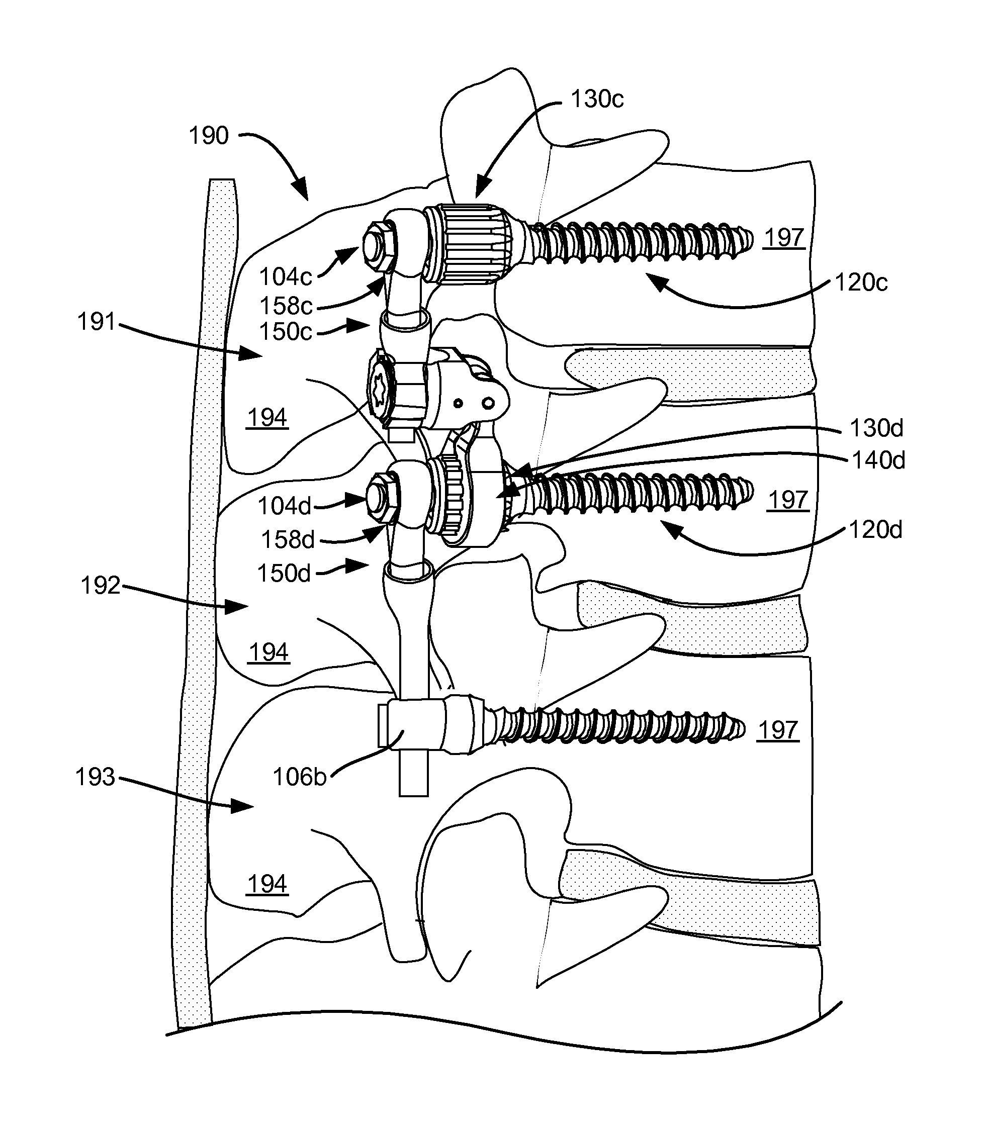 Compound spinal rod and method for dynamic stabilization of the spine