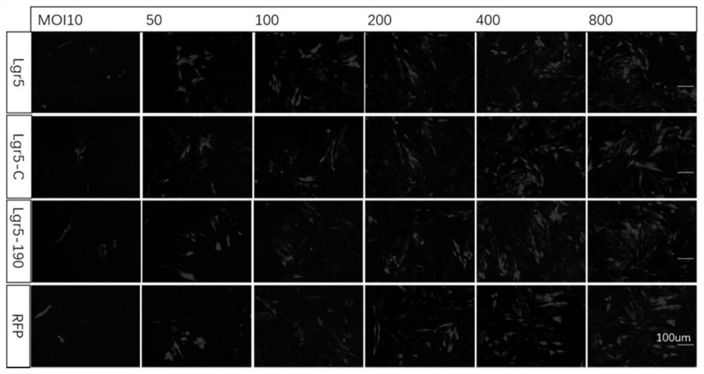 Application of Lgr5 gene in protection of inner ear hair cells and promotion of support cell regeneration