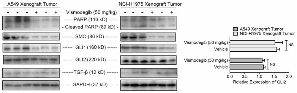 Pharmaceutical composition for treating non-small cell lung cancer