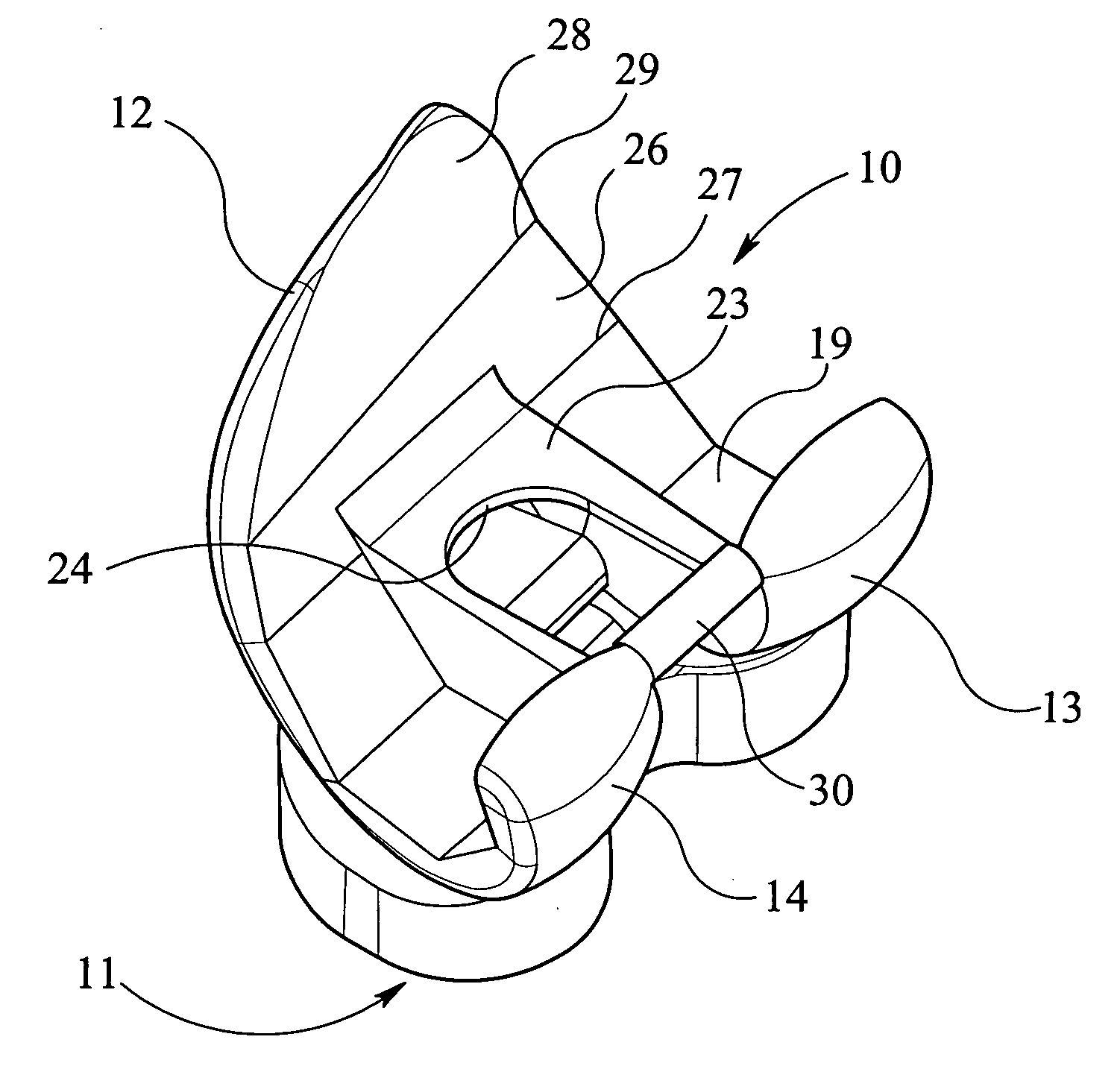 Knee prosthesis