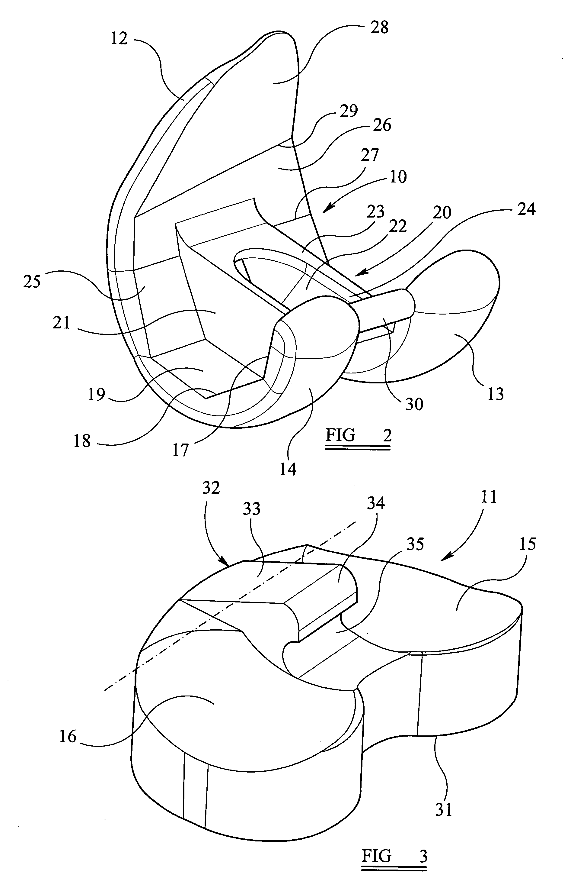 Knee prosthesis