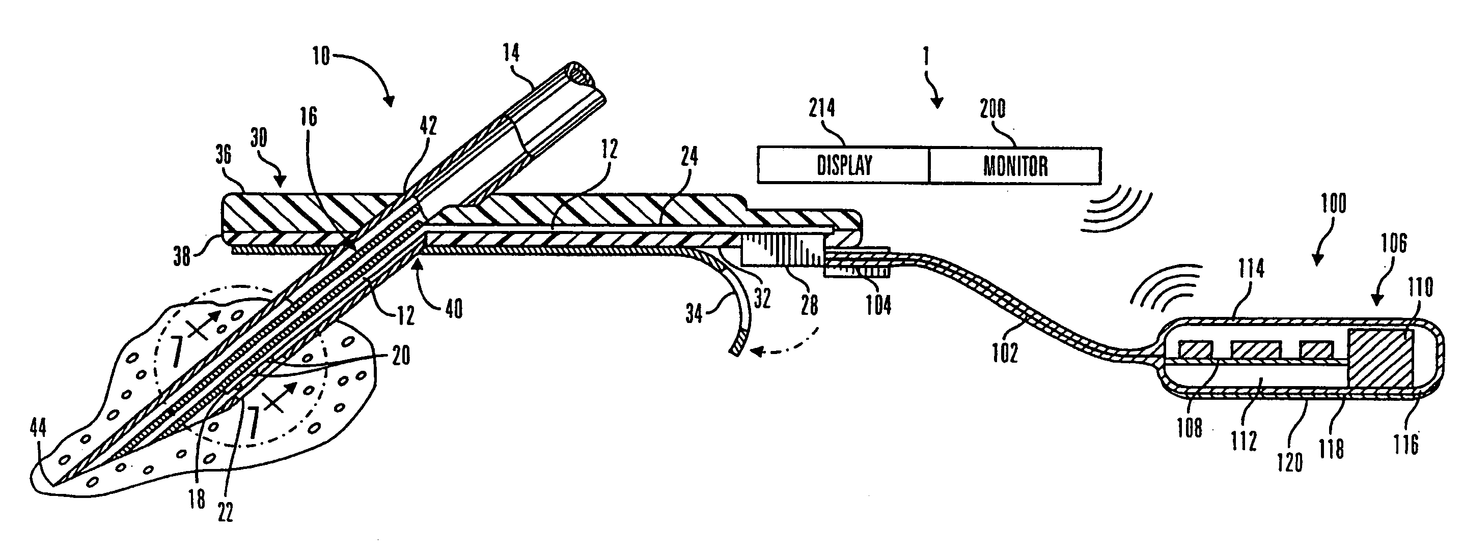 Telemetered characteristic monitor system and method of using the same