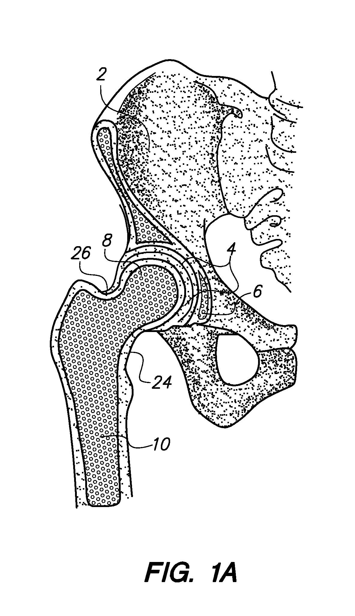 System and method for image-guided arthroscopy