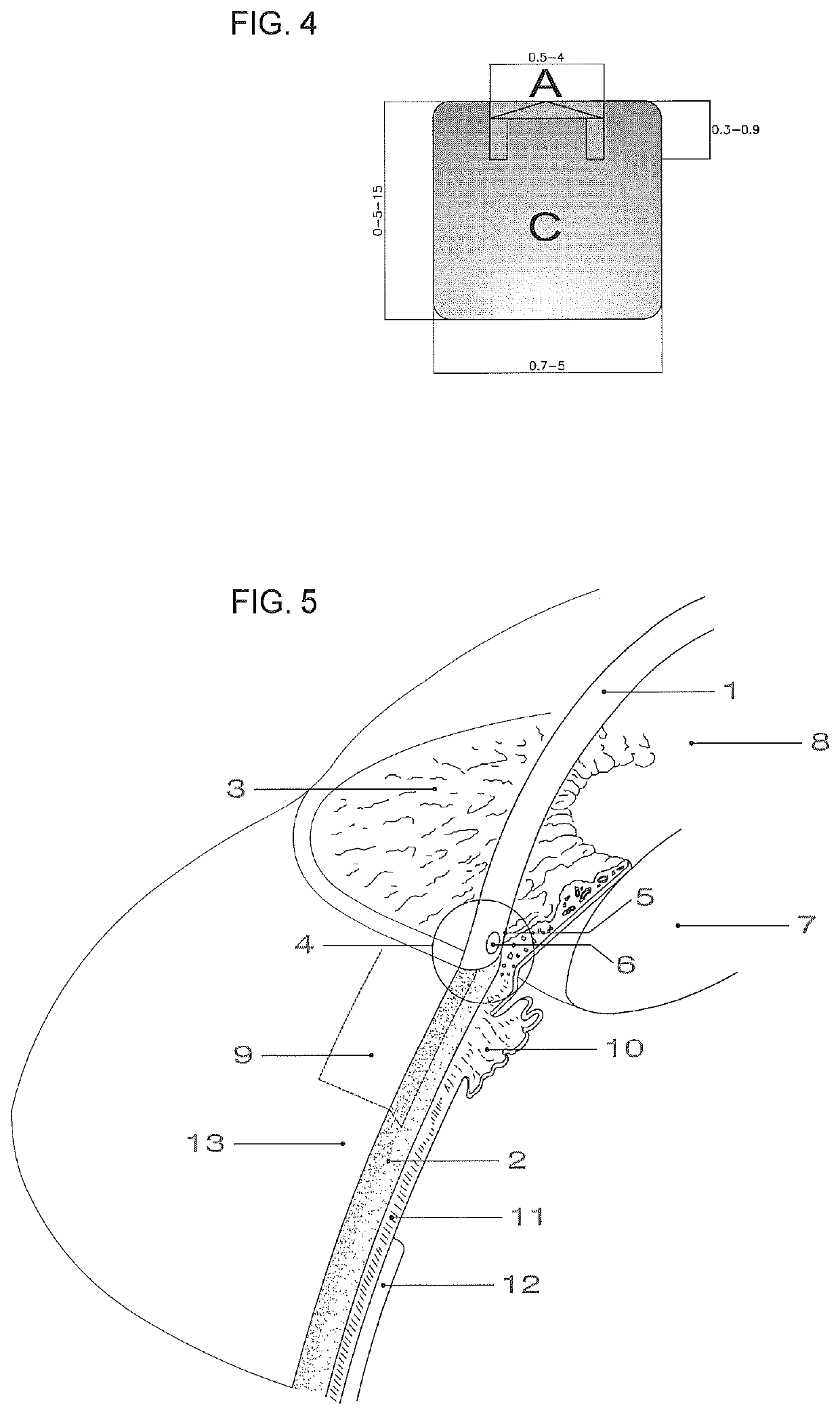 One piece flat device of for the drainage of aqueous humor from the eye