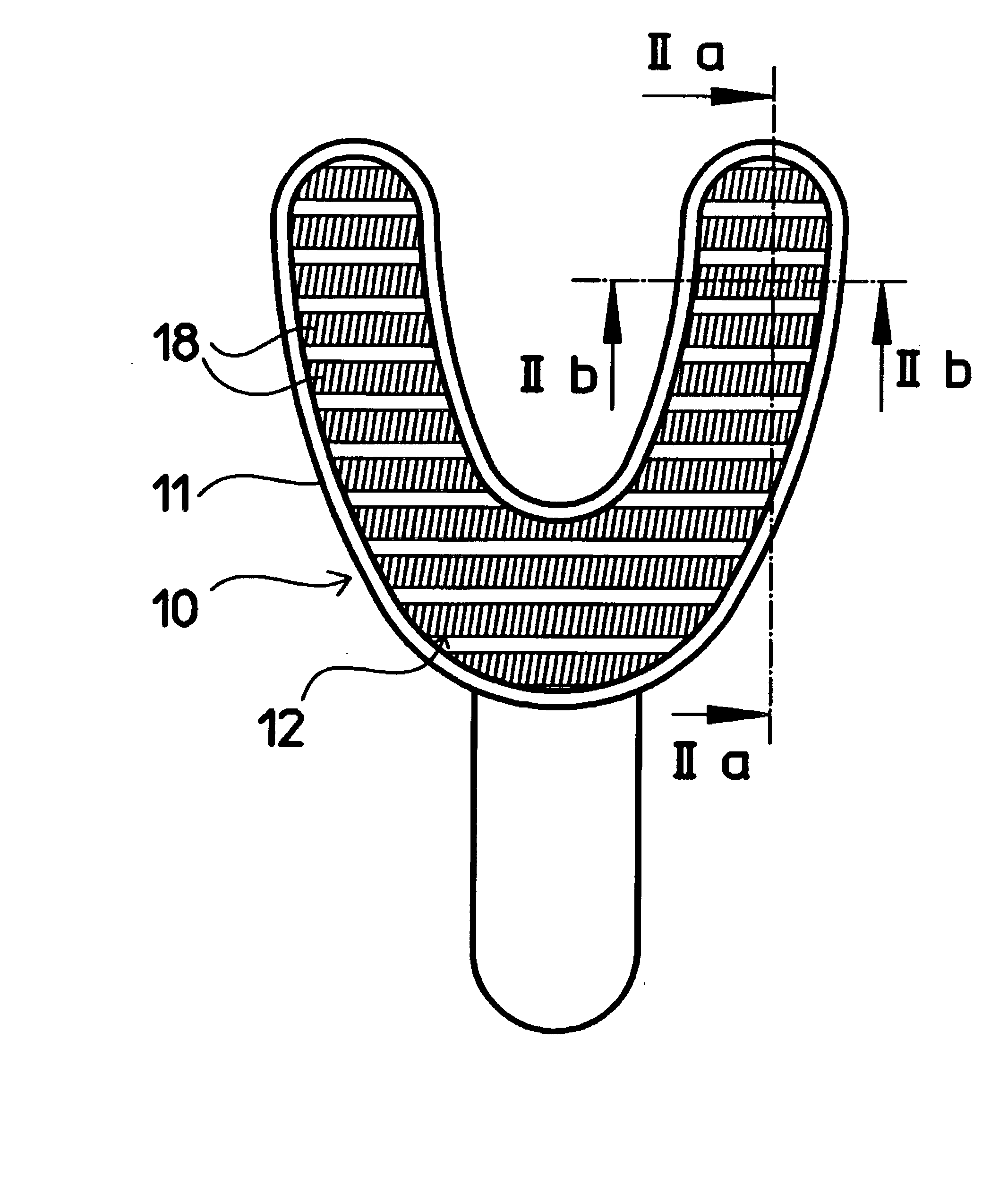 Dental impression tray with impression material retainer