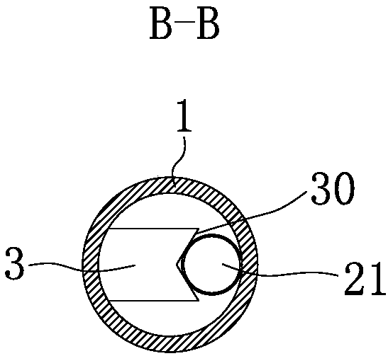 Tubular needle for acupuncture