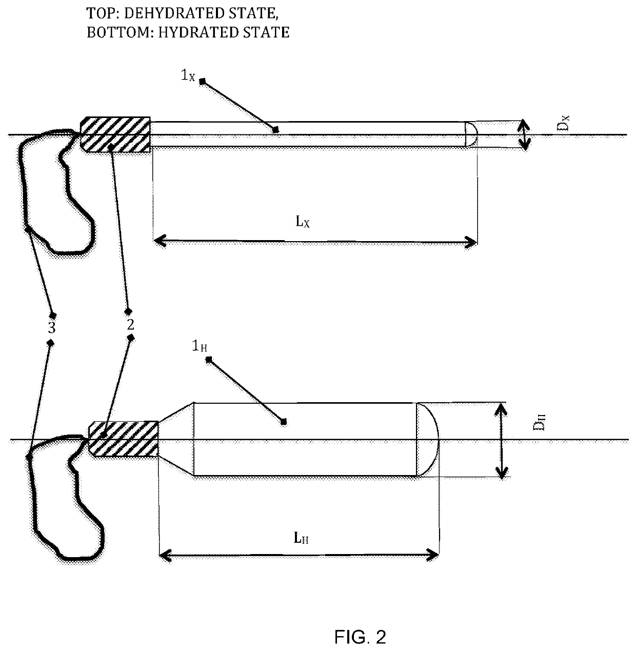 Combined osmotic and hydrogel cervical dilators and method of making same