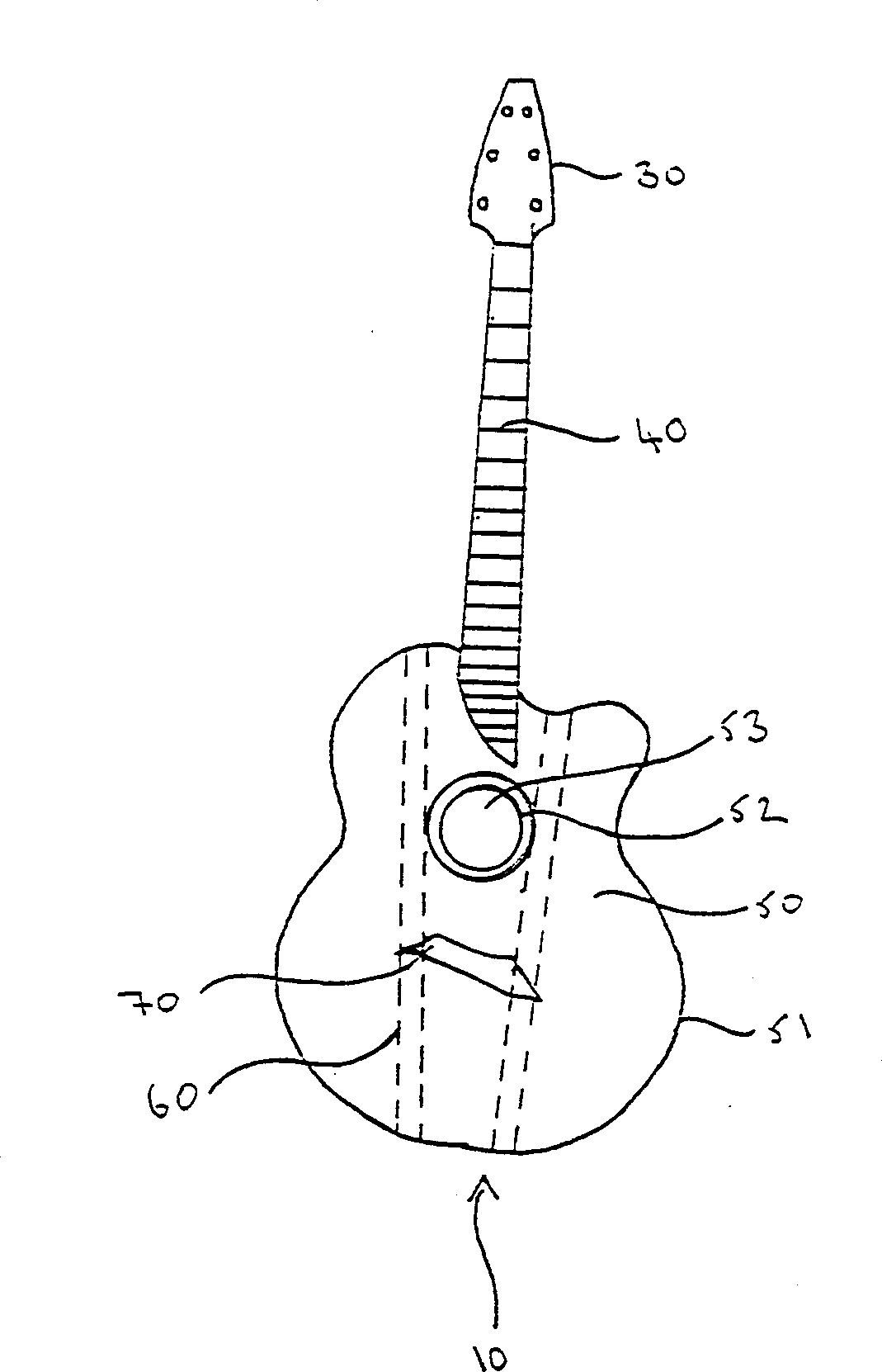 Acoustic device