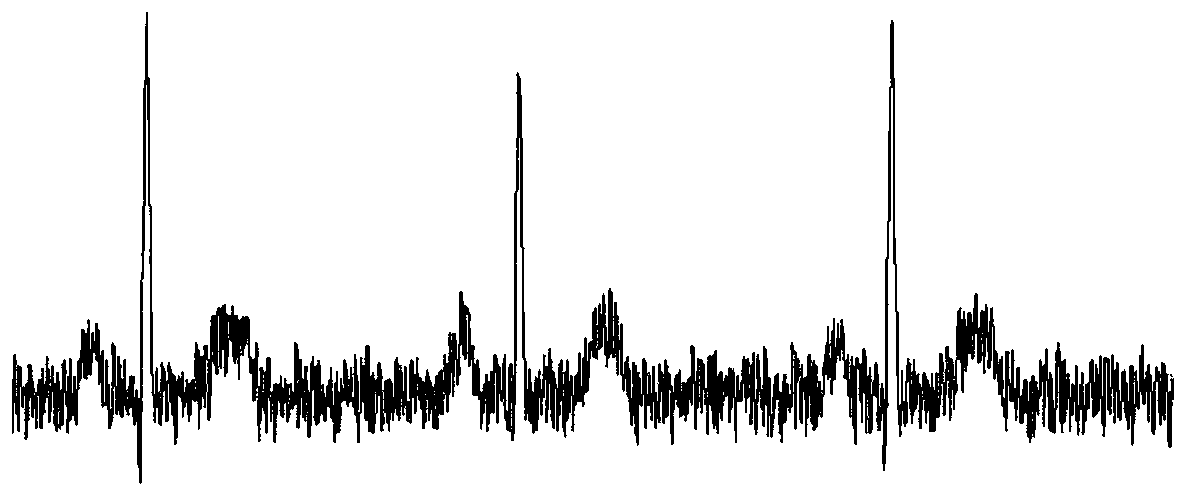 Method, device, electronic equipment and storage medium for electrocardiogram signal detection and classification