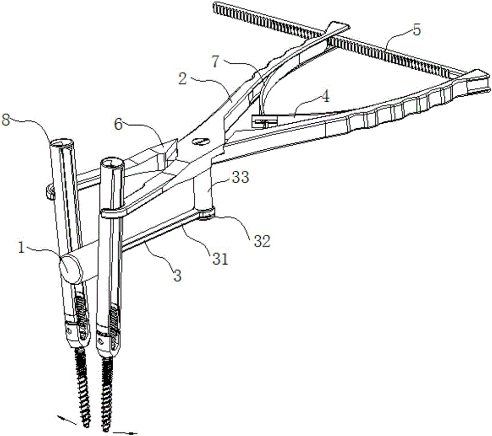 Distraction compression clamp for minimally invasive spine surgery