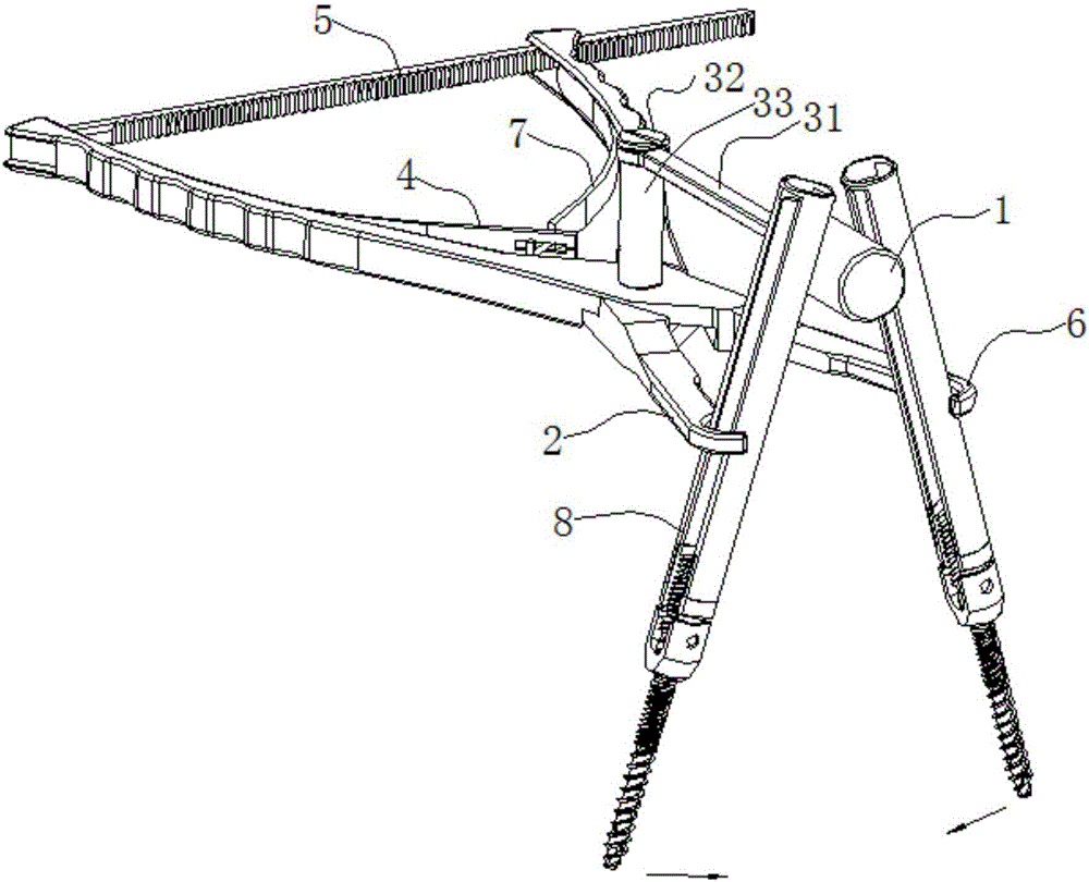 Distraction compression clamp for minimally invasive spine surgery