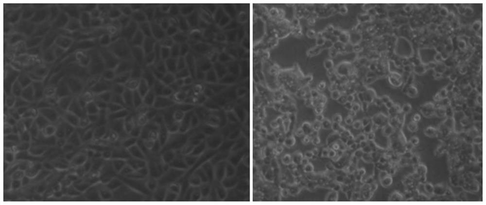 Attenuated strain freeze-dried vaccine of porcine pseudorabies virus